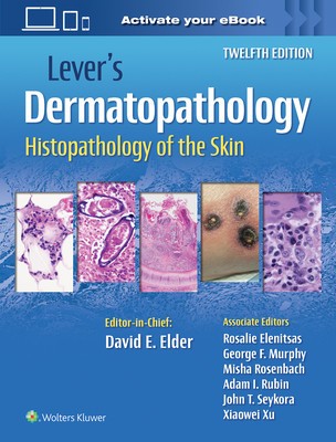 Lever&amp;#039;s Dermatopathology: Histopathology of the Skin foto