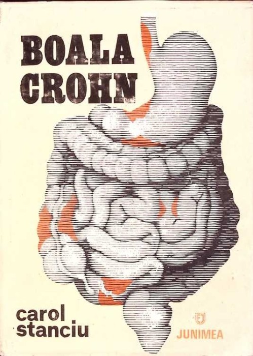 BOALA CROHN-CAROL STANCIU-276135