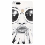 Husa silicon pentru Xiaomi Mi A1, Black And White Portrait Blonde Model In Fashion Sunglasses