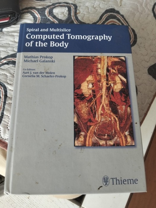 Spiral and Multislice Computed Tomography of the Body ( THIEME )