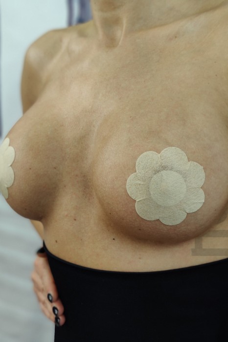TE70-152 Accesorii pentru sani, tip plasturi in forma de floare
