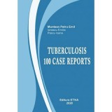 Tuberculosis. 100 casest- Emil-Petru Muntean