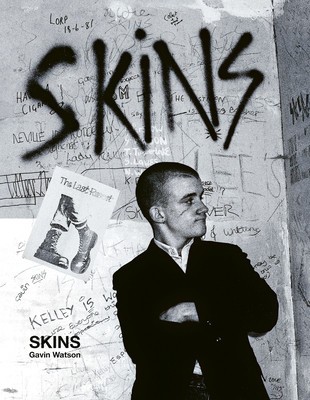Skins: Gavin Watson foto