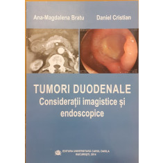 Tumori duodenale Consideratii imagistice si endoscopice