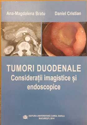 Tumori duodenale Consideratii imagistice si endoscopice foto