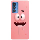 Husa compatibila cu Motorola Moto G51 5G model Patrick Drooling SpongeBob, Silicon, TPU, Viceversa, Transparent, Carcasa