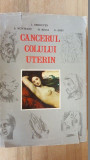 Cancerul colului uterin - I. Chiricuta, S. Muteanu, Ed. Dacia 1972, 341 pagini