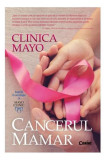 Clinica Mayo. Cancerul mamar, Corint