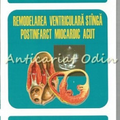 Remodelarea Ventriculara Stinga Postinfarct Miocardic Acut - I. Costache