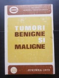Tumori benigne și maligne - Georgeta Tărăbuță-Cordun