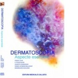Dermatoscopia - aspecte esentiale - Robert Johr, H. Peter Soyer, Giuseppe Argenziano