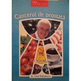Emil Radulescu - Cancerul de prostata (Editia: 2009)