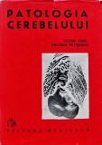 Patologia cerebelului - 1986 - Cezar Ionel ($T446)