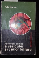 Patologia clinica a veziculei si cailor biliare foto