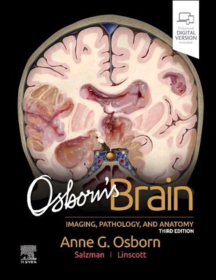 Osborn&#039;s Brain