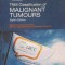 TNM CLASSIFICATION OF MALIGNANT TUMOURS-JAMES D. BRIERLEY-249580