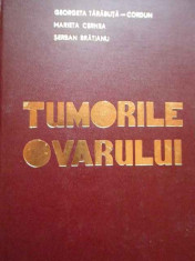 Tumorile Ovarului - Georgeta Tarabuta-cordun M. Cernea S. Bratianu ,278519 foto