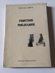 Fracturi Maleolare - Nicolaie Gorun foto