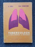 TUBERCULOZA LA VARSTA PUBERTATII SI ADOLESCENTEI - Sibila, Fierbinteanu