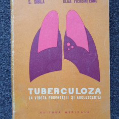 TUBERCULOZA LA VARSTA PUBERTATII SI ADOLESCENTEI - Sibila, Fierbinteanu