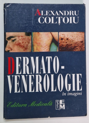 DERMATO-VENEROLOGIE IN IMAGINI de ALEXANDRU COLTOIU , COTOR LIPIT CU SCOCI foto