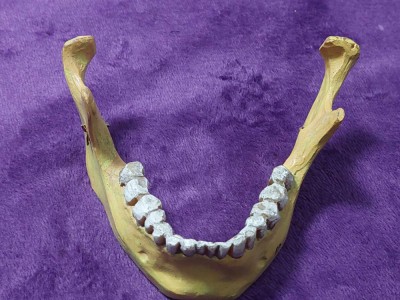 MANDIBULA Umana Didactica veche,mandibula anatomica craniu uman dinti inferiori foto