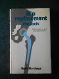 KEVIN HARDINGE - HIP REPLACEMENT. THE FACTS
