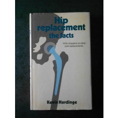 KEVIN HARDINGE - HIP REPLACEMENT. THE FACTS