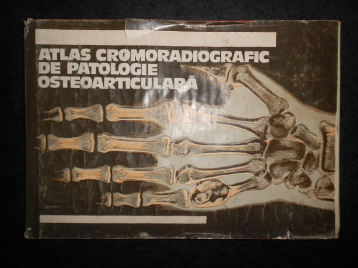 Aurel Denischi - Atlas cromoradiografic de patologie osteoarticulara