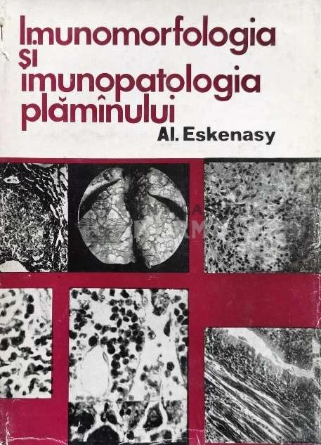 Imunomorfologia si imunopatologia plaminului - 1972 - AL. Eskenasy (@B156)