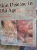 Skin Disease in Old Age - Ronald Marks