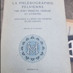 P. Guilhem, R. Baux - La Phlebographie Pelvienne Par Les Voies Veineuse, Osseuse et Uterine