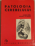 Patologia Cerebelului - Cezar Ionel, Arcadiu Petrescu