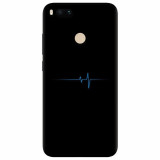 Husa silicon pentru Xiaomi Mi A1, Heartbeat