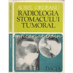 Radiologia Stomacului Tumoral - Aurel Ordeanu