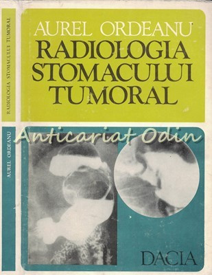 Radiologia Stomacului Tumoral - Aurel Ordeanu foto