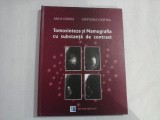 Tomosinteza si Mamografia cu substanta de contrast - Anca CIUREA / Cristina CIORTEA