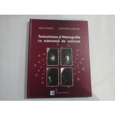 Tomosinteza si Mamografia cu substanta de contrast - Anca CIUREA / Cristina CIORTEA