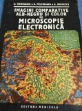 Imagini comparative de microscopie electronica