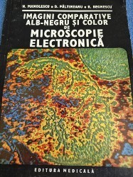 Imagini comparative de microscopie electronica foto