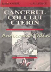 Cancerul Colului Uterin - Rodica Anghel, I. Balanescu foto