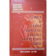 CLINICA SI TERAPIA EDENTATIEI PARTIALE INTERCALATE REDUSE-VASILE BURLUI, NORINA FORNA, GABRIELA IFTENI