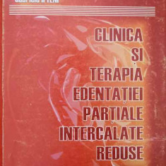 CLINICA SI TERAPIA EDENTATIEI PARTIALE INTERCALATE REDUSE-VASILE BURLUI, NORINA FORNA, GABRIELA IFTENI