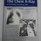 The Chest X-Ray A Systematic Teaching Atlas - editor M. HOFER