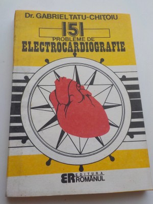 151 probleme de electrocardiografie - Gabriel Tatu Chițoiu foto