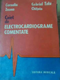 CAIET DE ELECTROCARDIOGRAME COMENTATE-C. ZEANA GABRIEL TATU CHITOIU