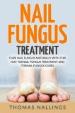 Nail Fungus Treatment: Cure Nail Fungus Naturally with This Fast Toenail Fungus Treatment and Toenail Fungus Cures