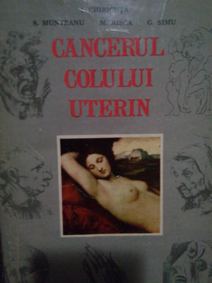 I. Chiricuta - Cancerul colului uterin (1972) foto