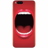 Husa silicon pentru Xiaomi Mi 6, Big Mouth