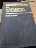 Angiofluorografia in diagnosticul oftalmologic - Gh. Munteanu